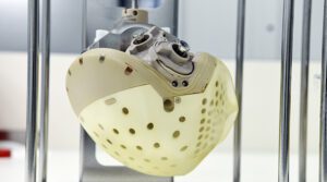 Carmat : Une R&eacute;volution dans le secteur des c&oelig;urs artificiels